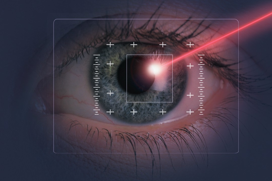 Jakie są najczęstsze mity dotyczące laserowej korekcji wzroku?