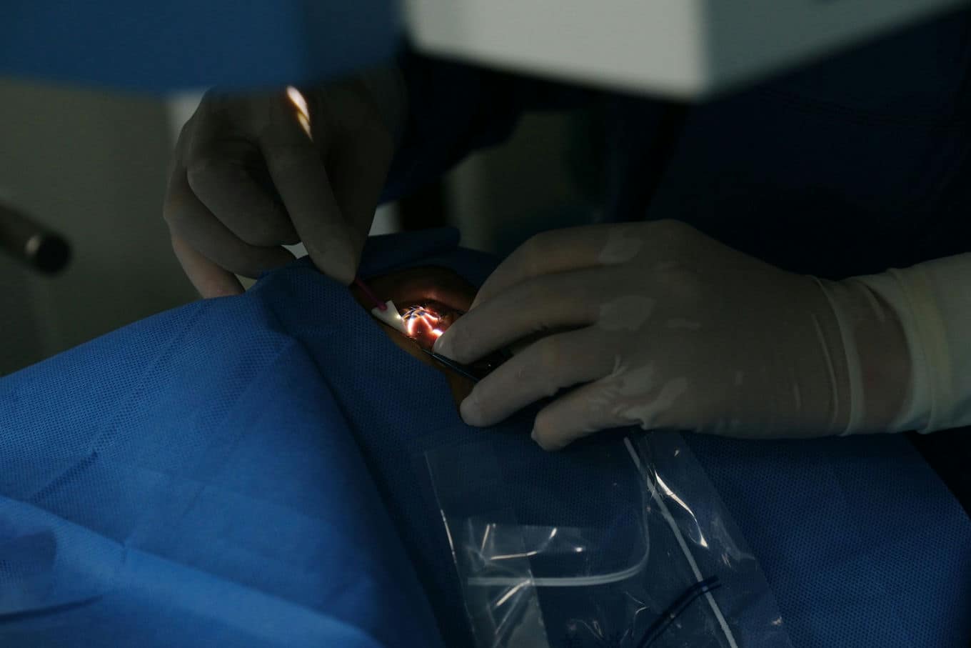 Laserowa korekcja wzroku – popraw jakość widzenia