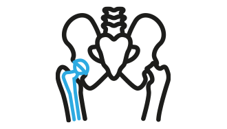 Endoprotezoplastyka stawu biodrowego icon